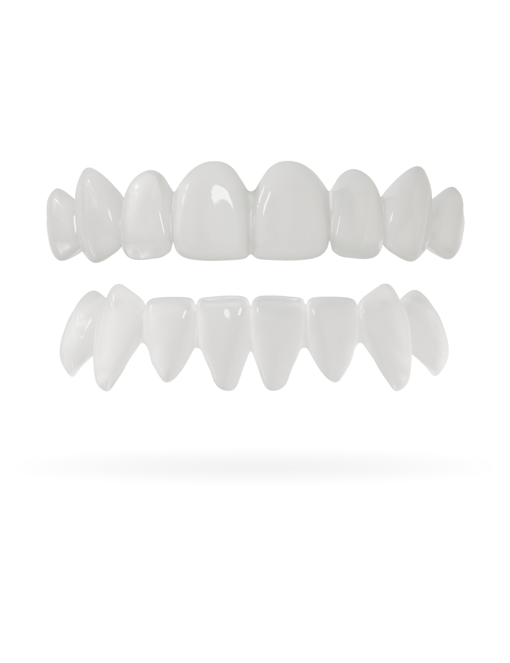 Zahn-Veneer 3.0