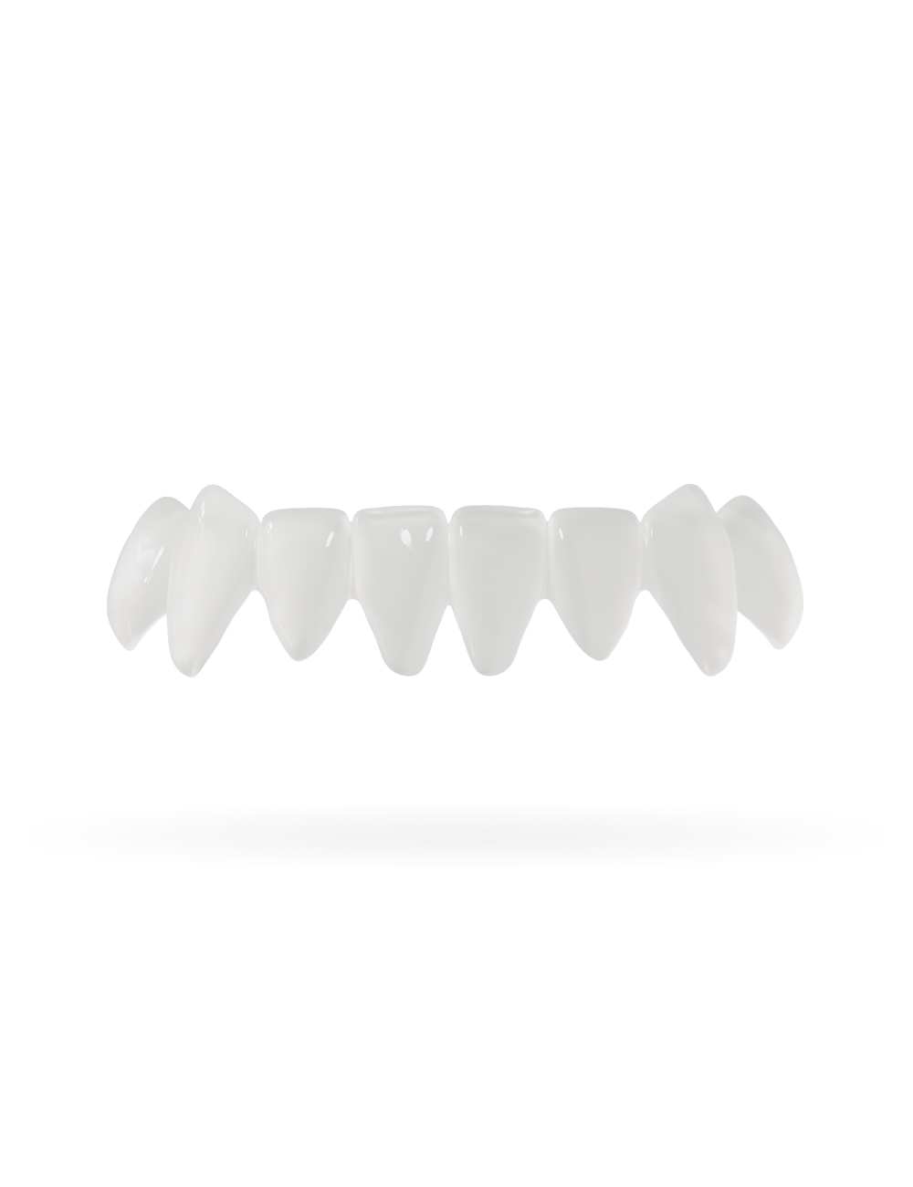 Veneera-Zahn-Veneers-Zahn-VeneerUntenHollywood-min