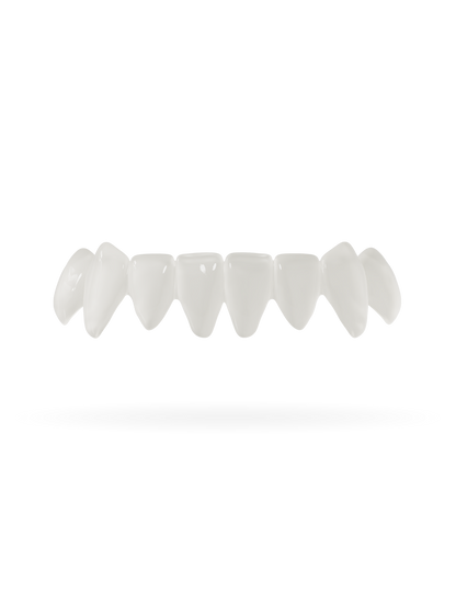 Veneera-Zahn-Veneers-Zahn-VeneerUntenNaturweiss