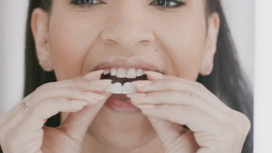 Veneera™ Veneers - ZAHN-VENEER AUFSTECKEN